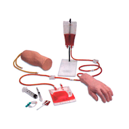 �ֲ����ⲿ�M��ʽ�o�}ݔҺ��Ѫ��Ӗ(x��n)��ģ��