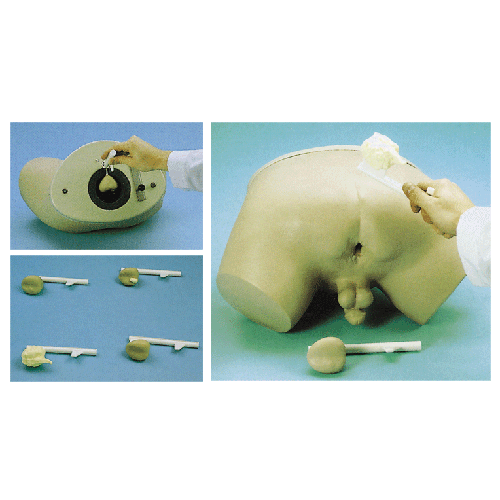 ǰ���ٙz��ģ��