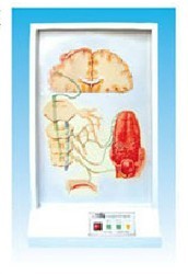 ζ�X(ju��)����(d��o)ͨ·늄�(d��ng)ģ��