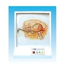 ���X(ju��)����(d��o)ͨ·늄�(d��ng)ģ��