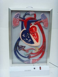 �ք�Һ��ʽѪҺѭ�h(hu��n)늄�ģ��